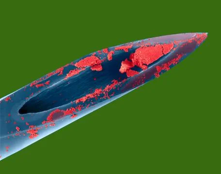 Hypodermic needle with blood, SEM 写真素材