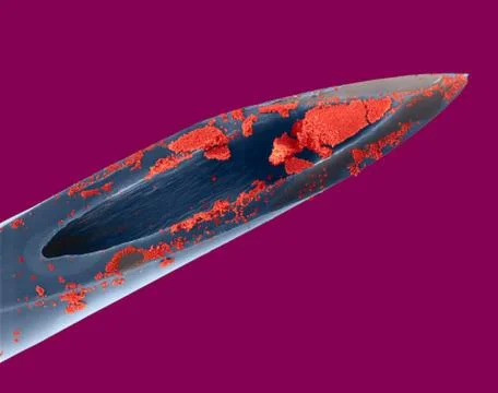 Hypodermic needle with blood, SEM Stock Photos