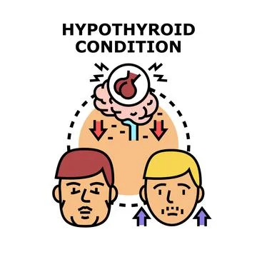 Hypothyroid condition affecting metabolism and body health Stock Illustration