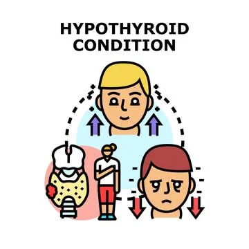 Hypothyroid condition causing body and mood changes Stock Illustration