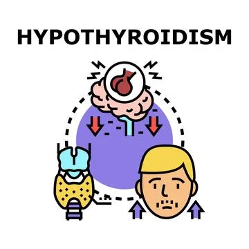 Hypothyroidism concept showing thyroid hormone deficiency symptoms Stock Illustration