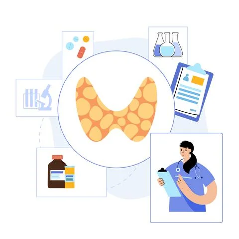 Hypothyroidism thyroid gland Stock Illustration