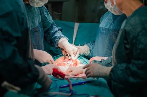 Hysterectomy surgery. Stock Photos