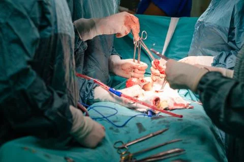 Hysterectomy surgery. Stock Photos