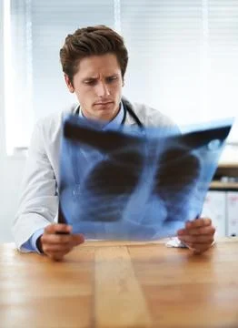 I cant see any problem...a concerned-looking young doctor examining a chest x Stock Photos