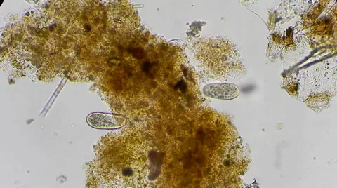 Ibfusoria feeding under microscope Видео 33661672