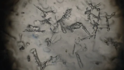 Ice crystals in a microscope Stock Footage 98480776