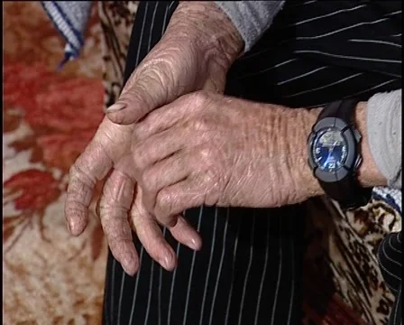 Ichthyosis Vídeo Stock 1340536