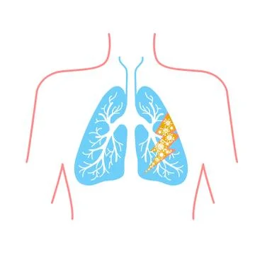 Icon of lung disease Stock Illustration