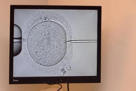  Icsi Medically assisted procreation centre. Biology laboratory. IVF by IC... Stock Photos