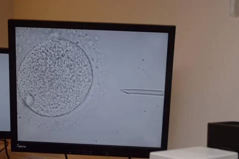  Icsi Medically assisted procreation centre. Biology laboratory. IVF by IC... Stock Photos