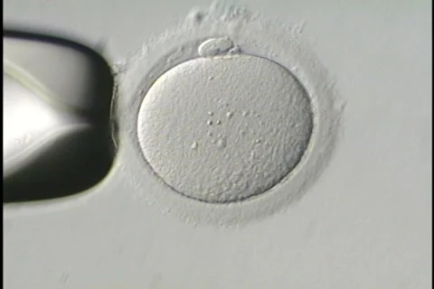 ICSI microscopic procedure Video stock 435294