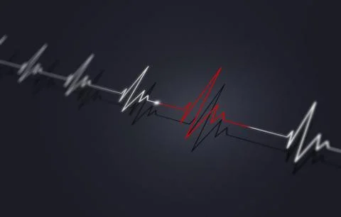 Identification of heart arrhythmia Stock Illustration