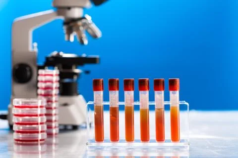 Identification of pathogenic microbes and viruses Foto stock