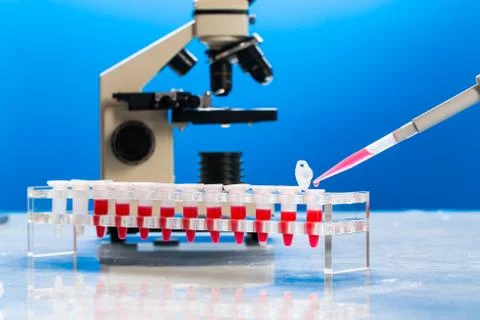Identification of pathogenic microbes and viruses Foto stock