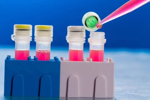 Identification of pathogenic microbes and viruses Foto stock