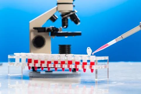 Identification of pathogenic microbes and viruses Foto stock