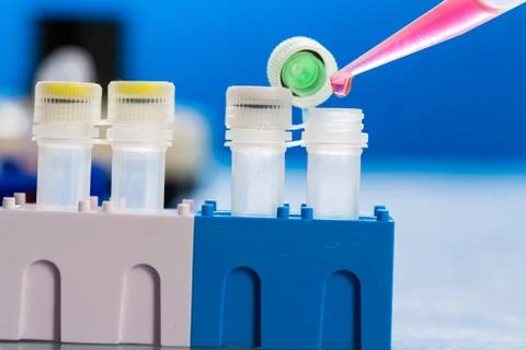 Identification of pathogenic microbes and viruses Foto stock
