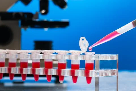 Identification of pathogenic microbes and viruses Foto stock