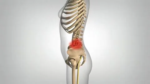 If compression occurs in the C5 nerve root between the C4 and C5 vertebrae, w Stock Illustration