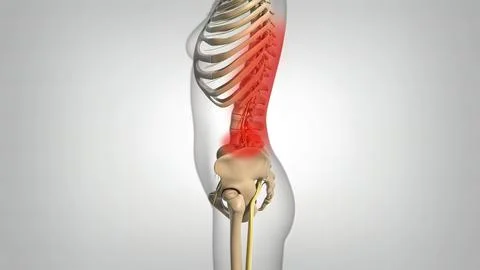 If compression occurs in the C5 nerve root between the C4 and C5 vertebrae, w Stock Illustration