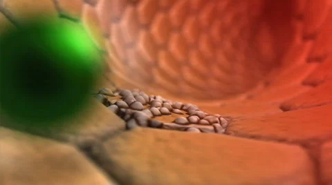 Ill cell and green medicine Stock Footage