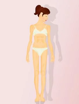 Illustration of anorexia Illustrazione stock