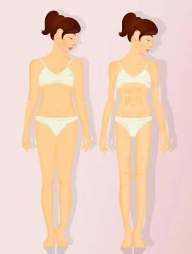 Illustration of anorexia Stock Illustration