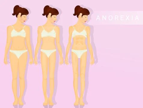 Illustration of anorexia Illustrazione stock