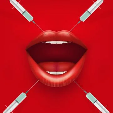 Illustration of a Botox injection. Stock Illustration