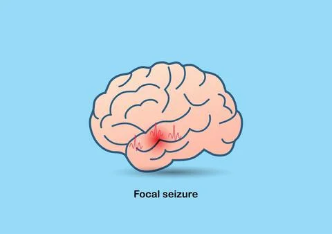 Illustration of brain and abnormal brain waves Stock Illustration