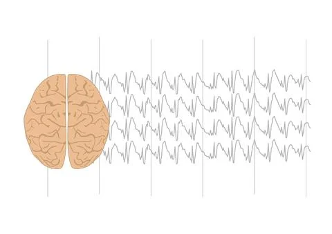 Illustration of brain and genearlized sharp waves Stock Illustration