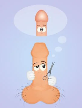 Illustration of circumcision Stock Illustration
