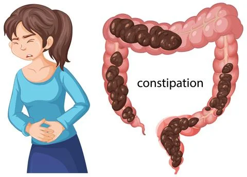 Illustration of Constipation with Human Anatomy Stock Illustration