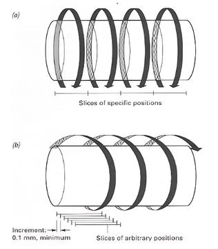 Illustration of CT Scanning Techniques: Slice-by-Slice and Spiral Volume Im.. Stock Photos