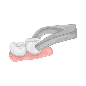 Illustration of Dental extraction forceps Stock Illustration
