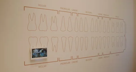 An illustration of different human teeth types displayed on a wall for education Stock Footage 318280009