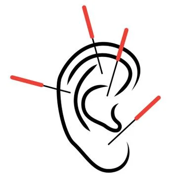 Illustration of ear acupuncture Stock Illustration