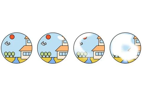 Illustration of glaucoma, changes in visual field as glaucoma progresses, Stock Illustration