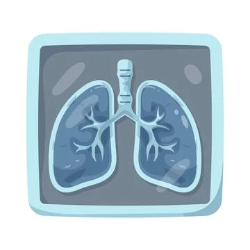 Illustration of human lungs x-ray Stock Illustration