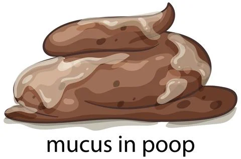 Illustration of Mucus in Stool Stock Illustration