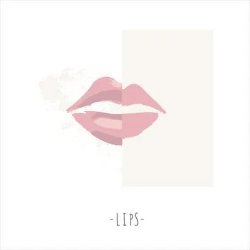 Illustration of a procedure lip augmentation 库存插图
