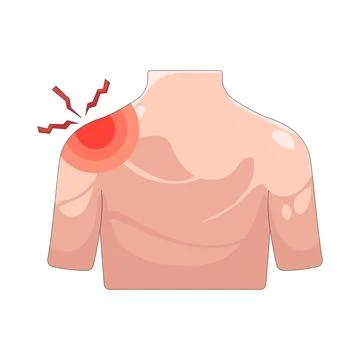 Illustration of Shoulder pain Stock Illustration