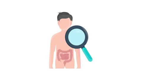 Illustration showing steps to check for colon cancer, including visual aids.. Stock Footage 332535147