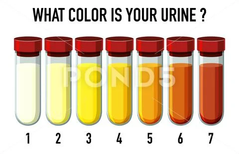 Illustration of urine color chart ~ Clip Art #143573199