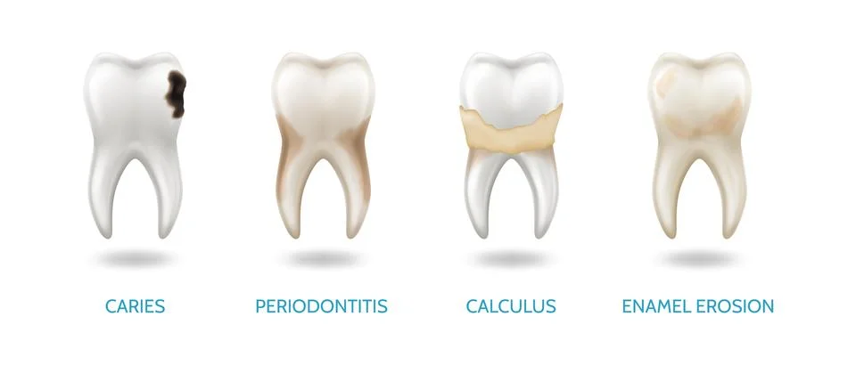 Illustrations of Common Dental Problems Illustrazione stock