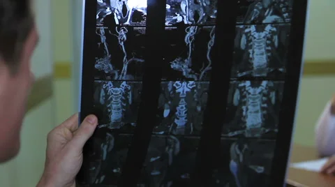 Image analysis of computed tomography (CT) and MRI snapshot Stock Footage 50084705