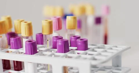 Image of close up of test tubes on white background Stock Photos