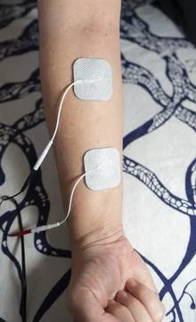 Image of electro-stimulator on the forearm Stock Photos