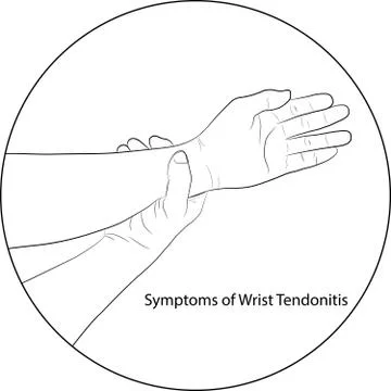 Image graphics vector outline Wrist pain is often caused by sprains Stock-Illustration